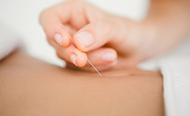 Dry Needling