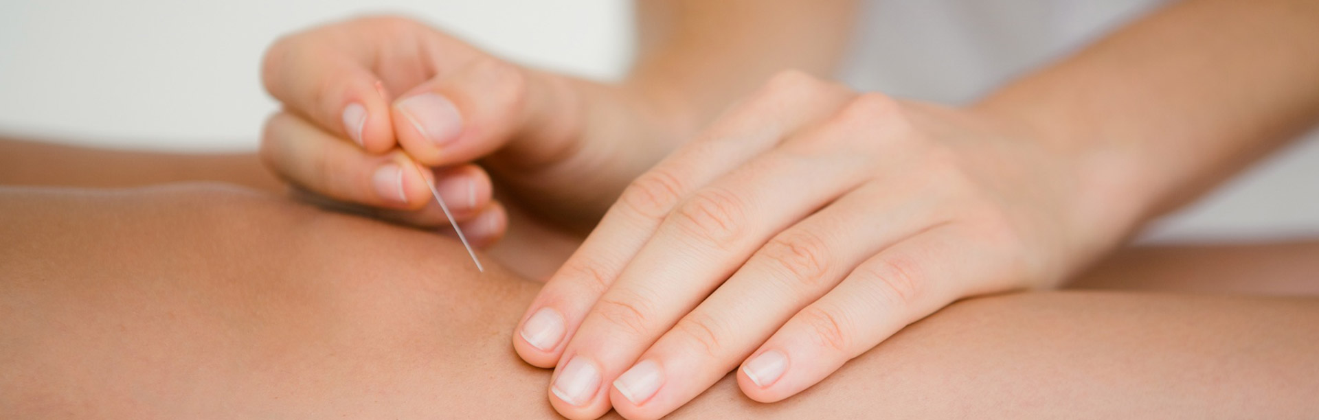 Dry Needling